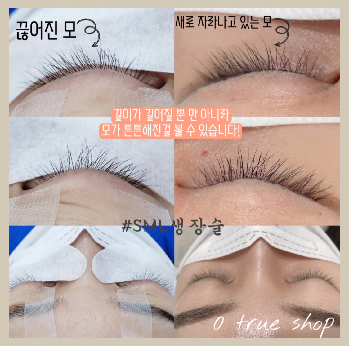 영트루샵 대표 이미지