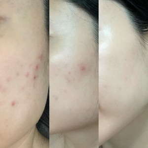 온뷰티 photo 4