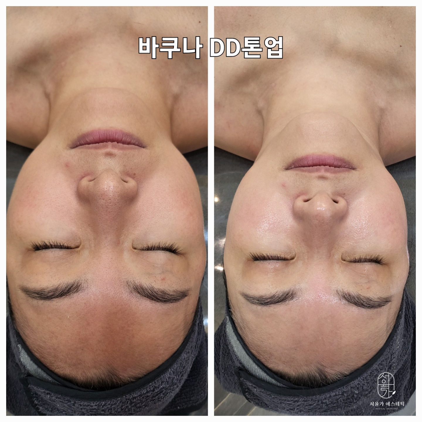 온뷰티 photo 2