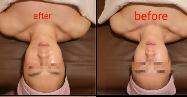 아이디스파 숲칼프 양양점 photo 9