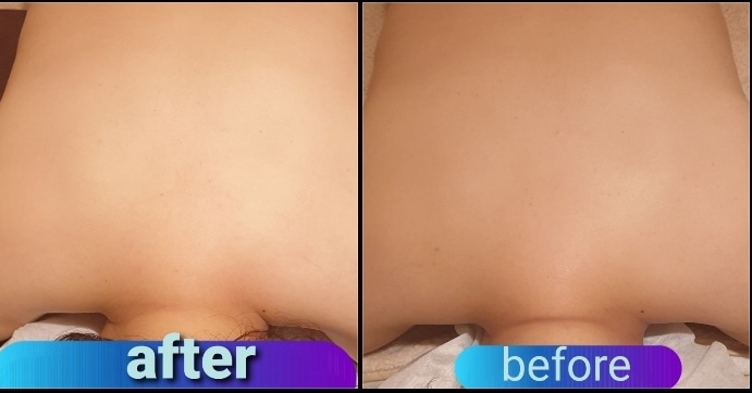 아이디스파 숲칼프 양양점 photo 8