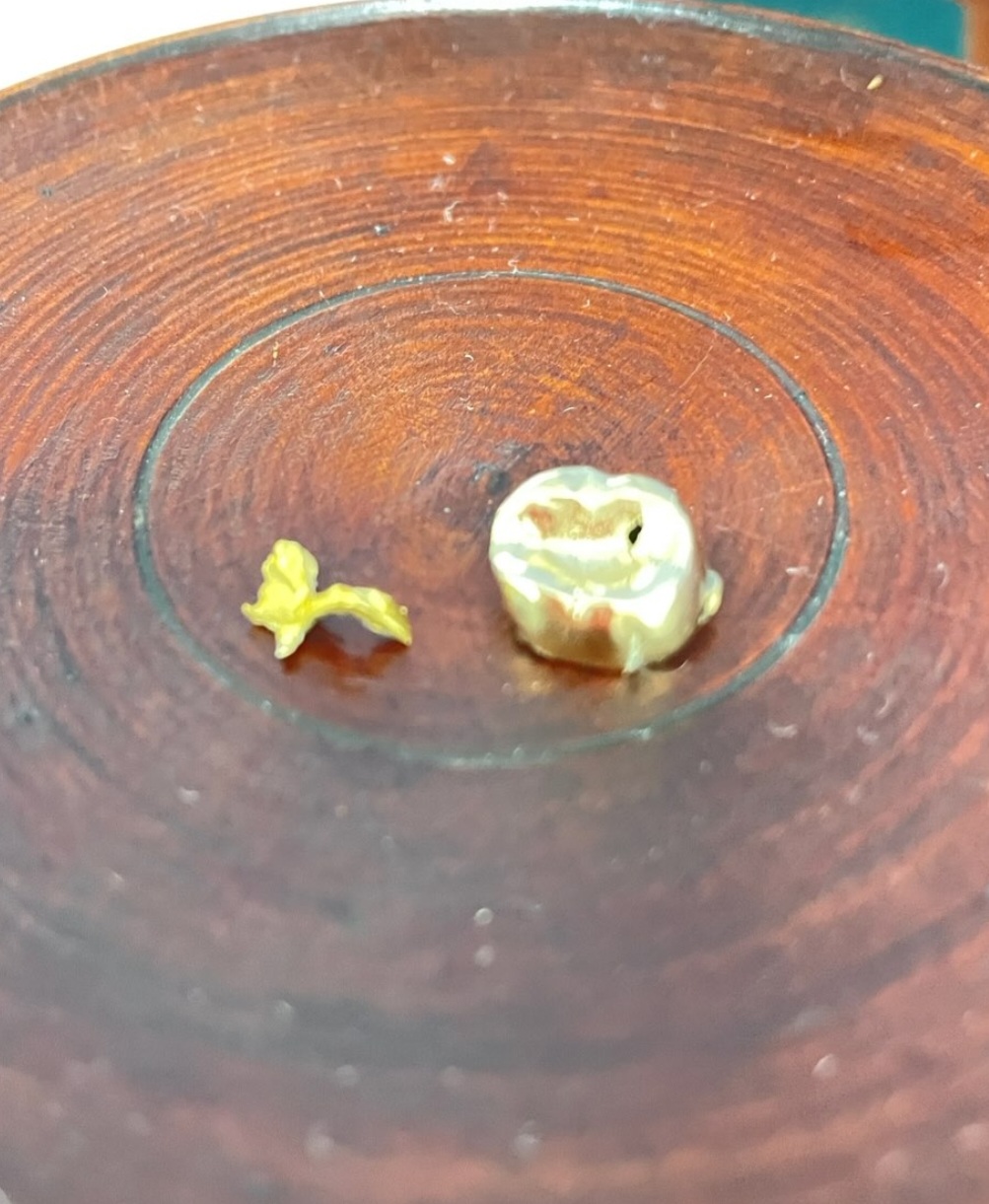 황금빛깔 금니거래소 대표 이미지