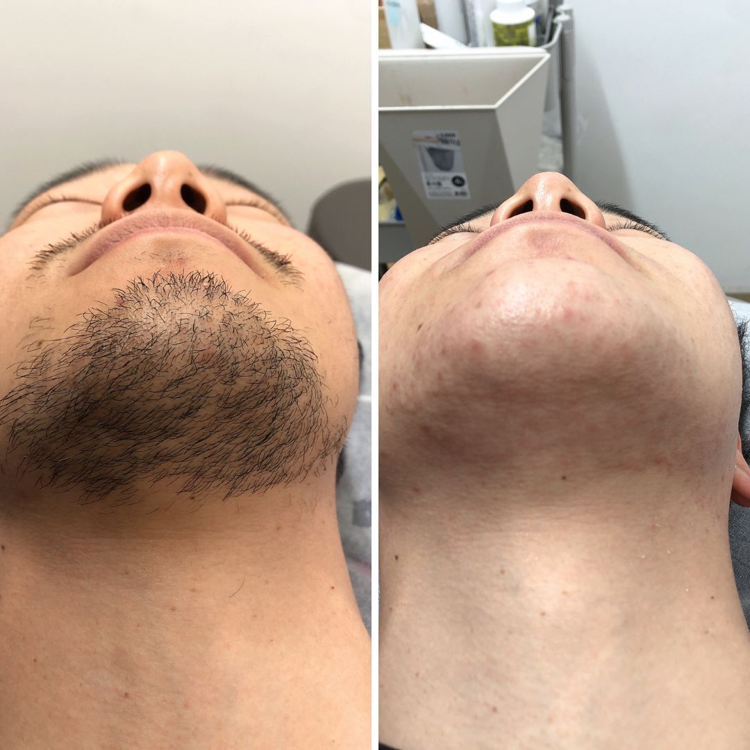 에나왁싱 부평본점