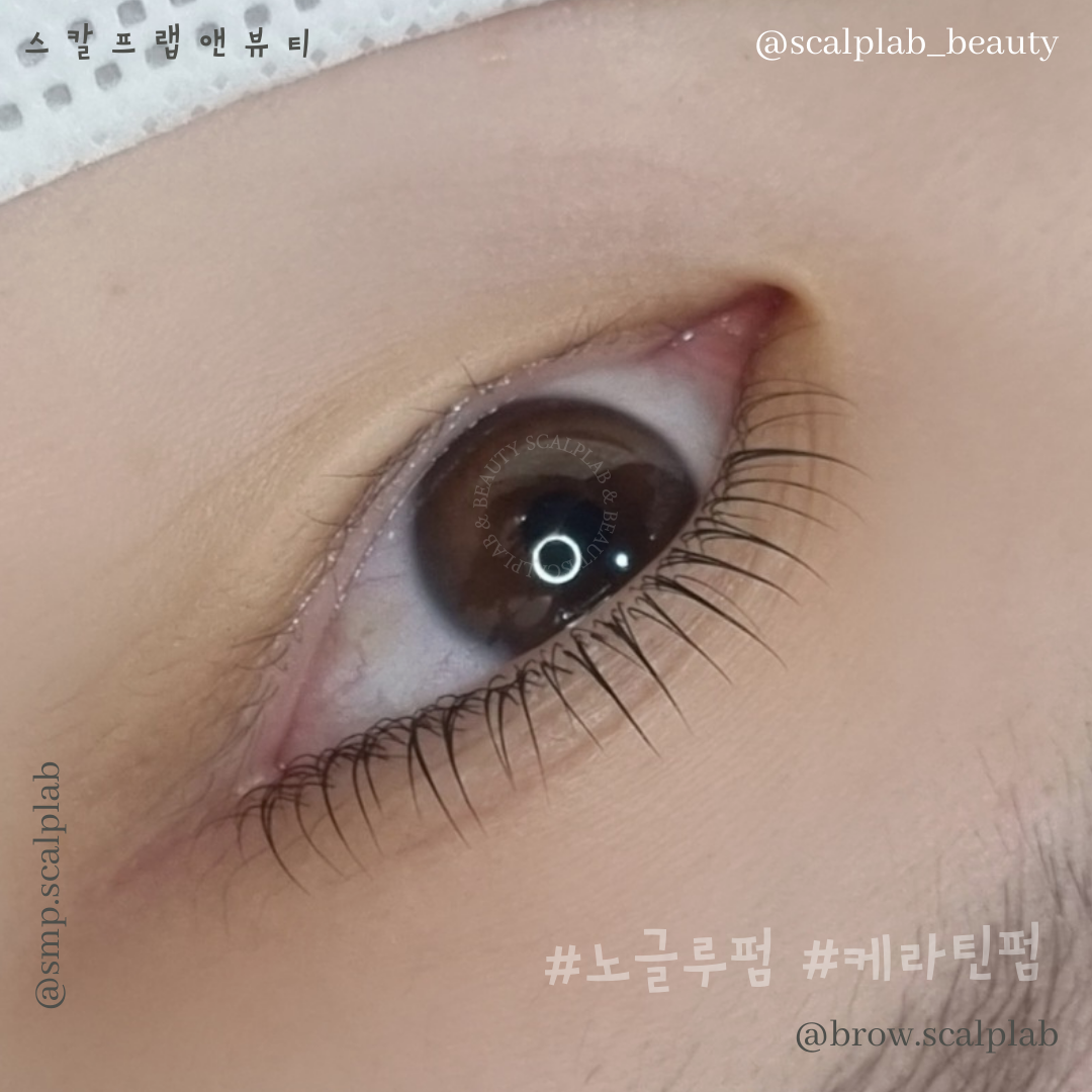 스칼프랩앤뷰티