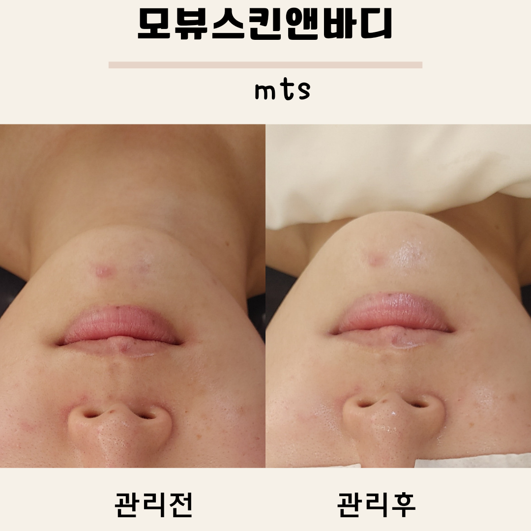모뷰스킨앤바디