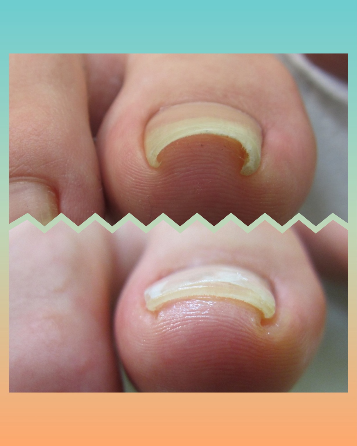 숲칼프레이디 대표 이미지