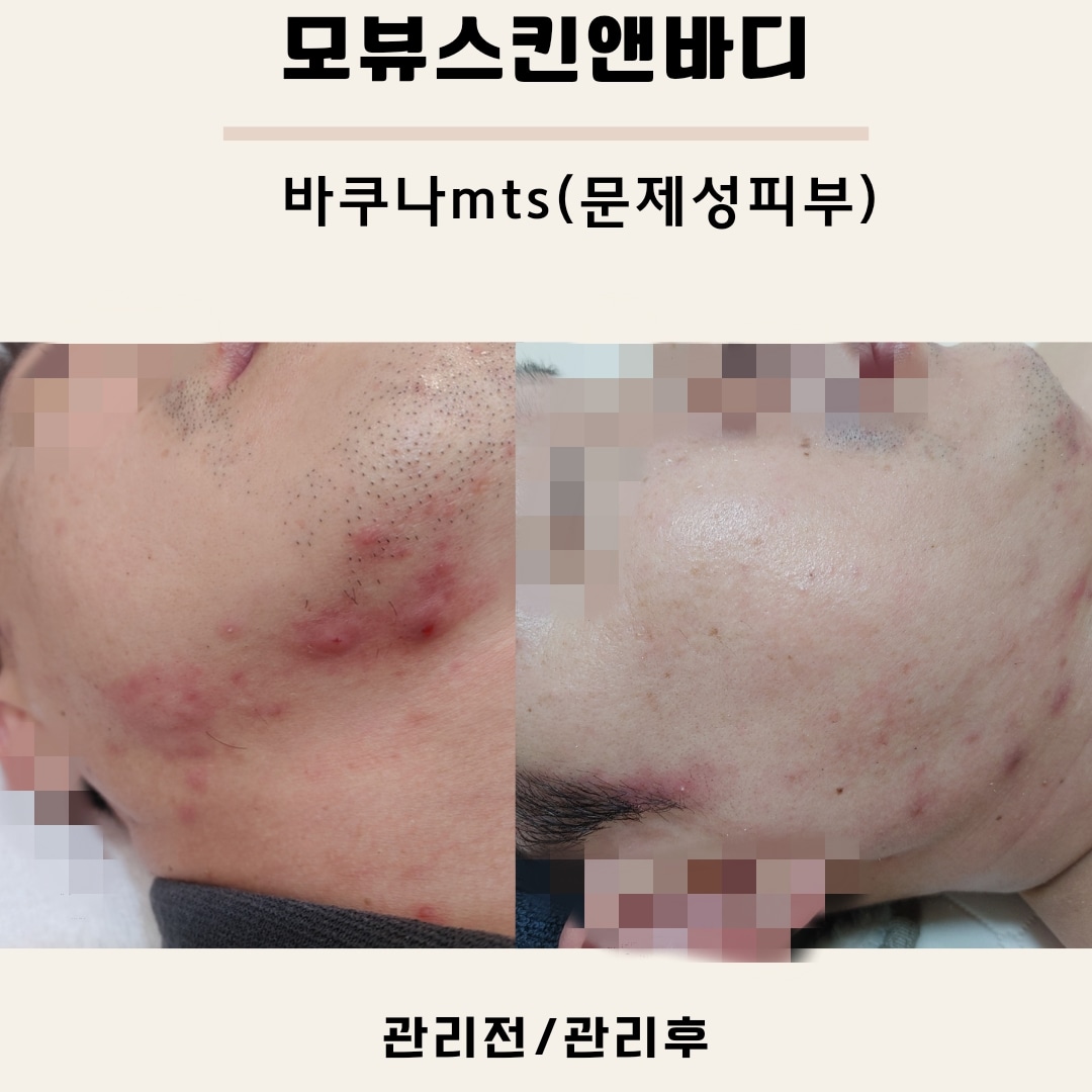 모뷰스킨앤바디