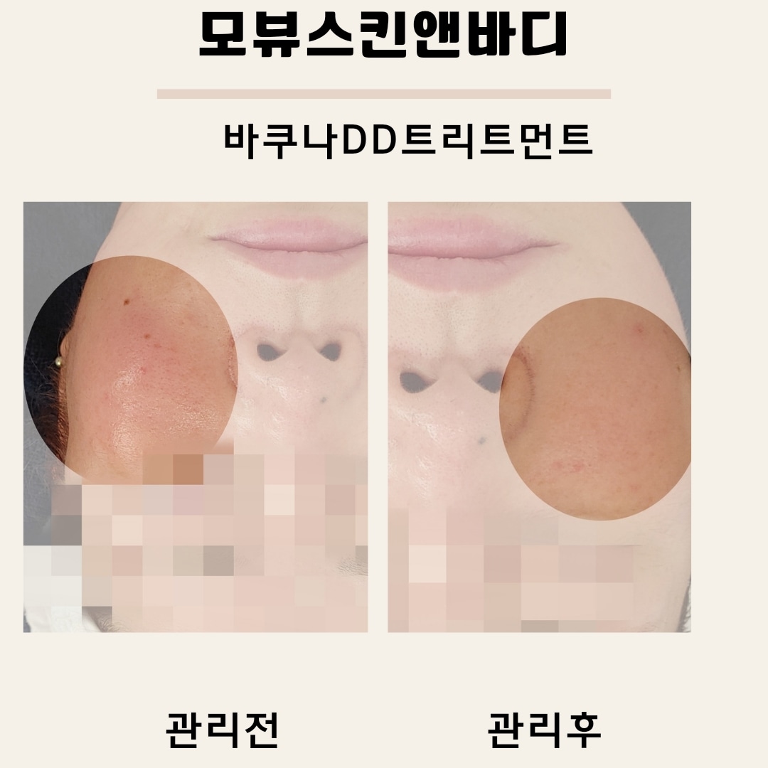 모뷰스킨앤바디