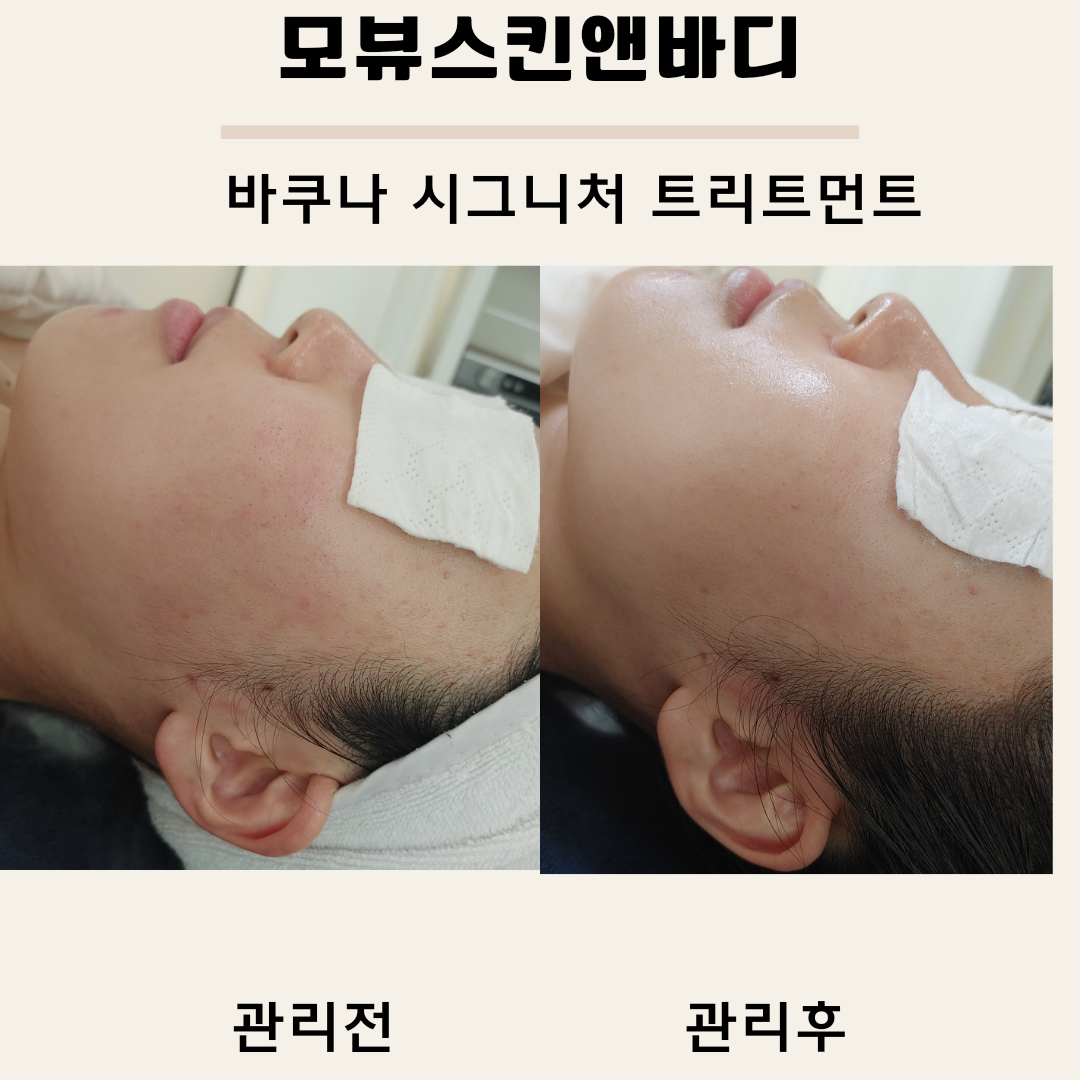 모뷰스킨앤바디