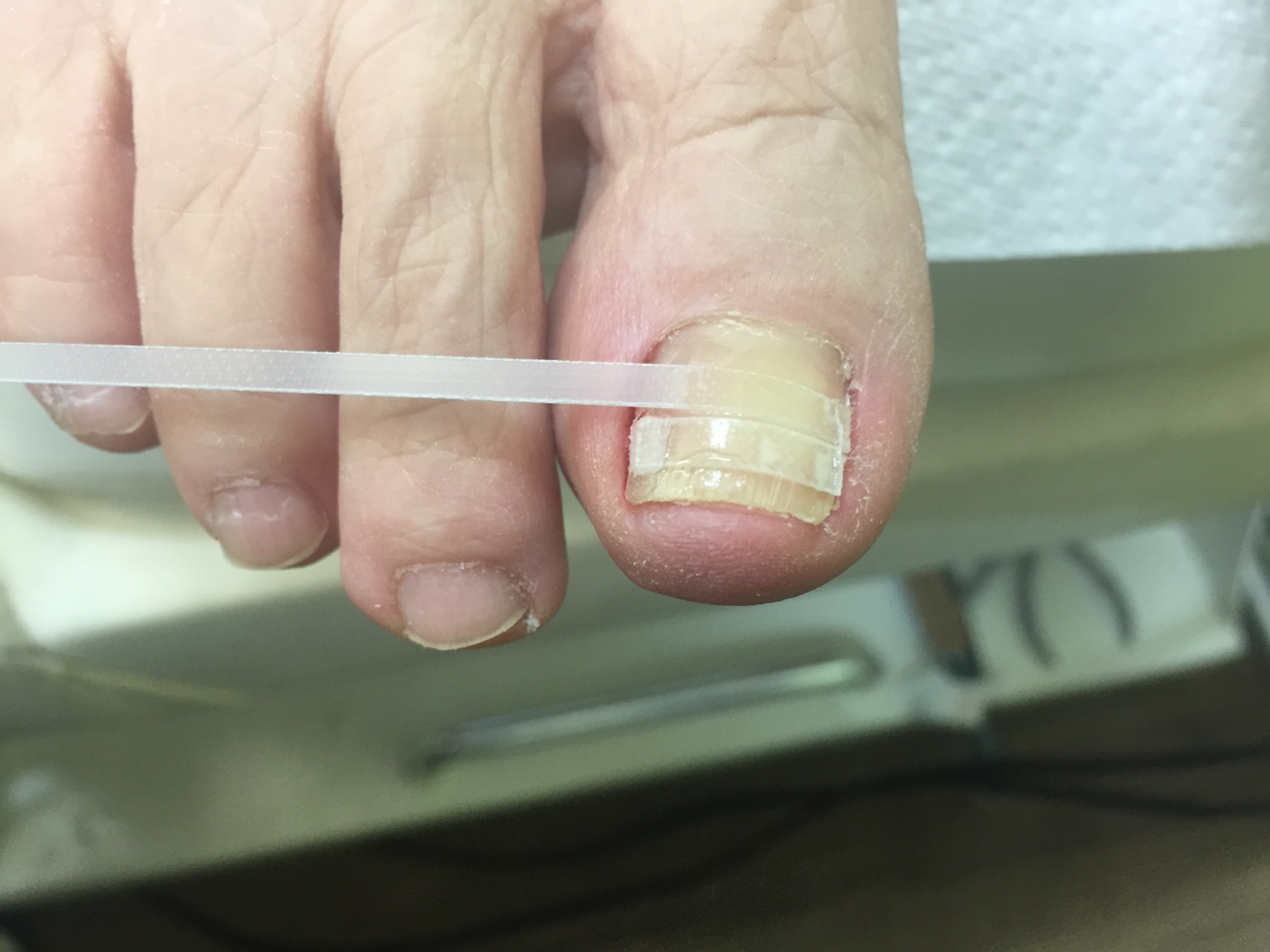 숲칼프레이디 대표 이미지