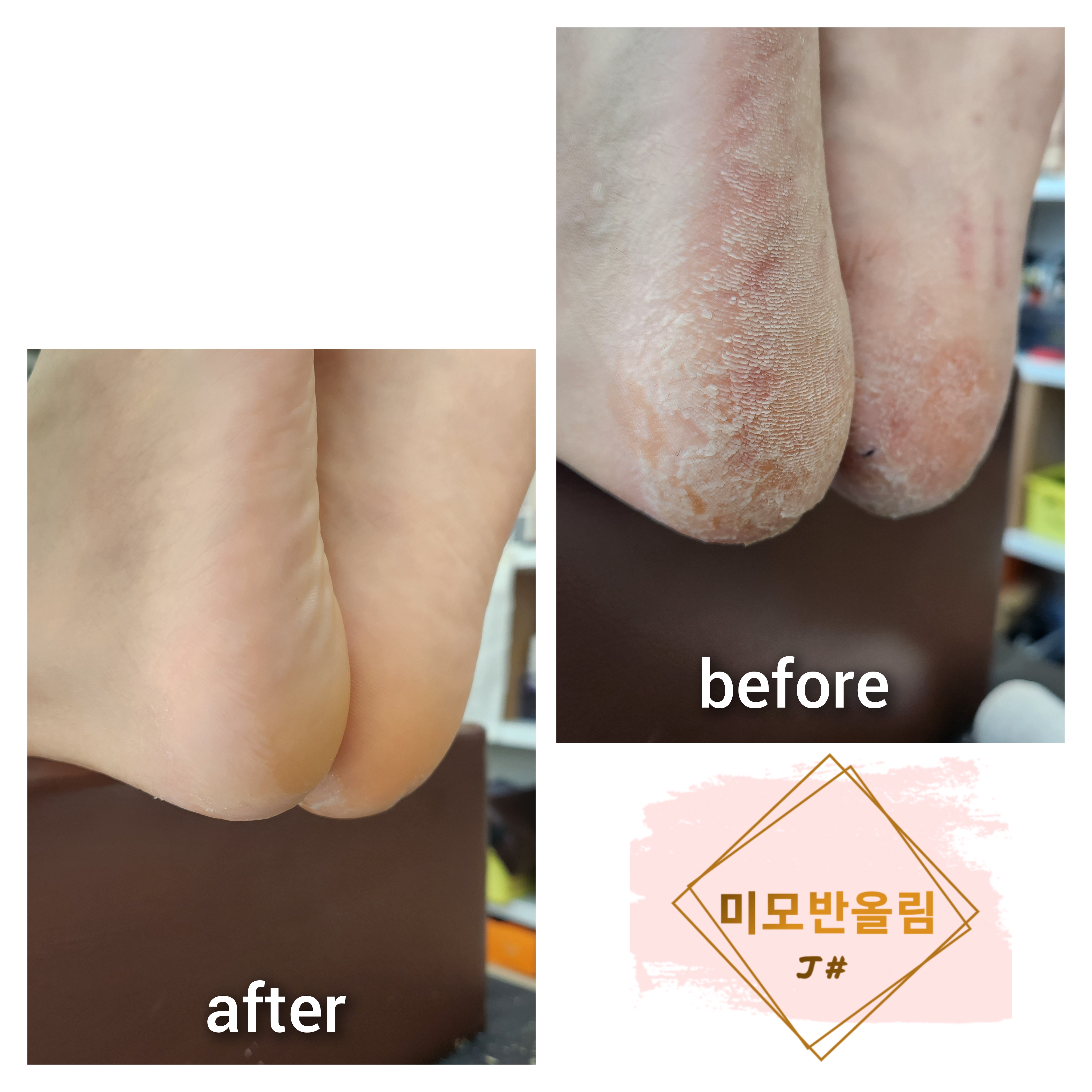 미모반올림