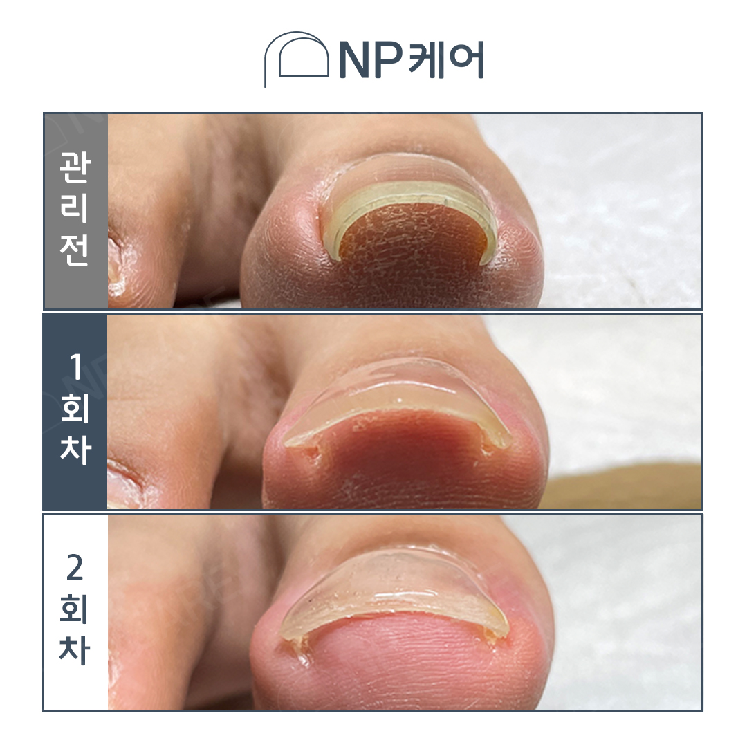 엔피케어 부산센텀점
