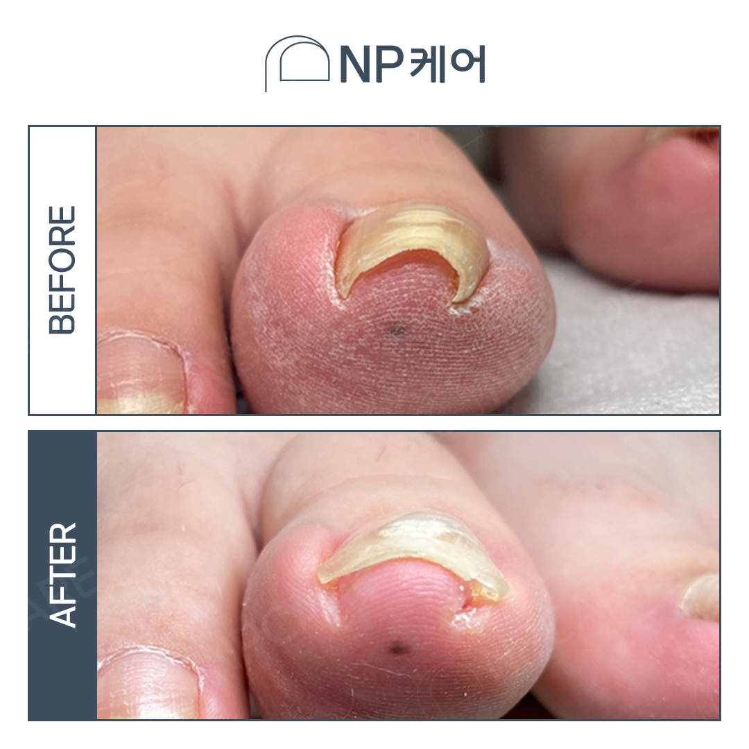 엔피케어 부산센텀점