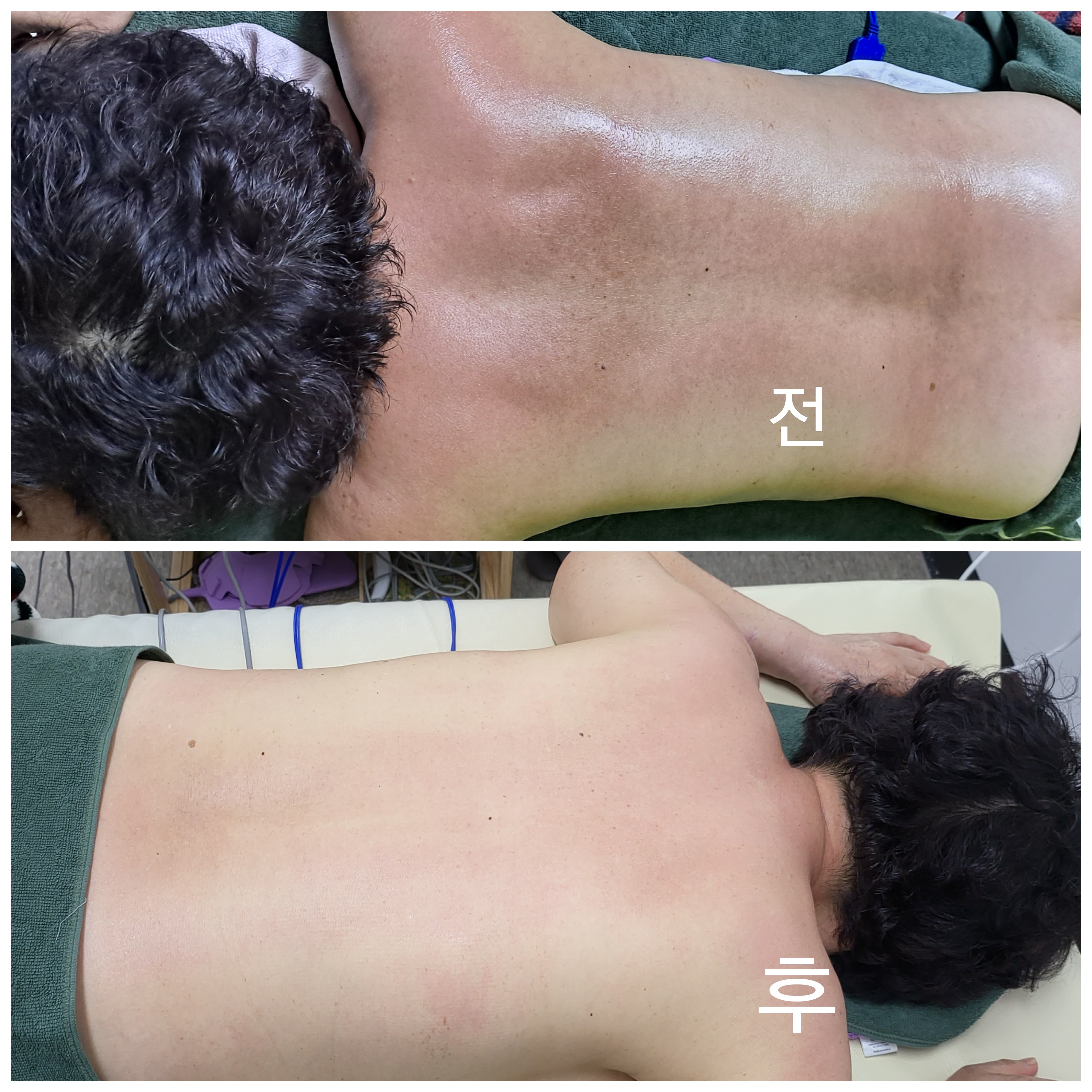 빽스테라피 익산영등동