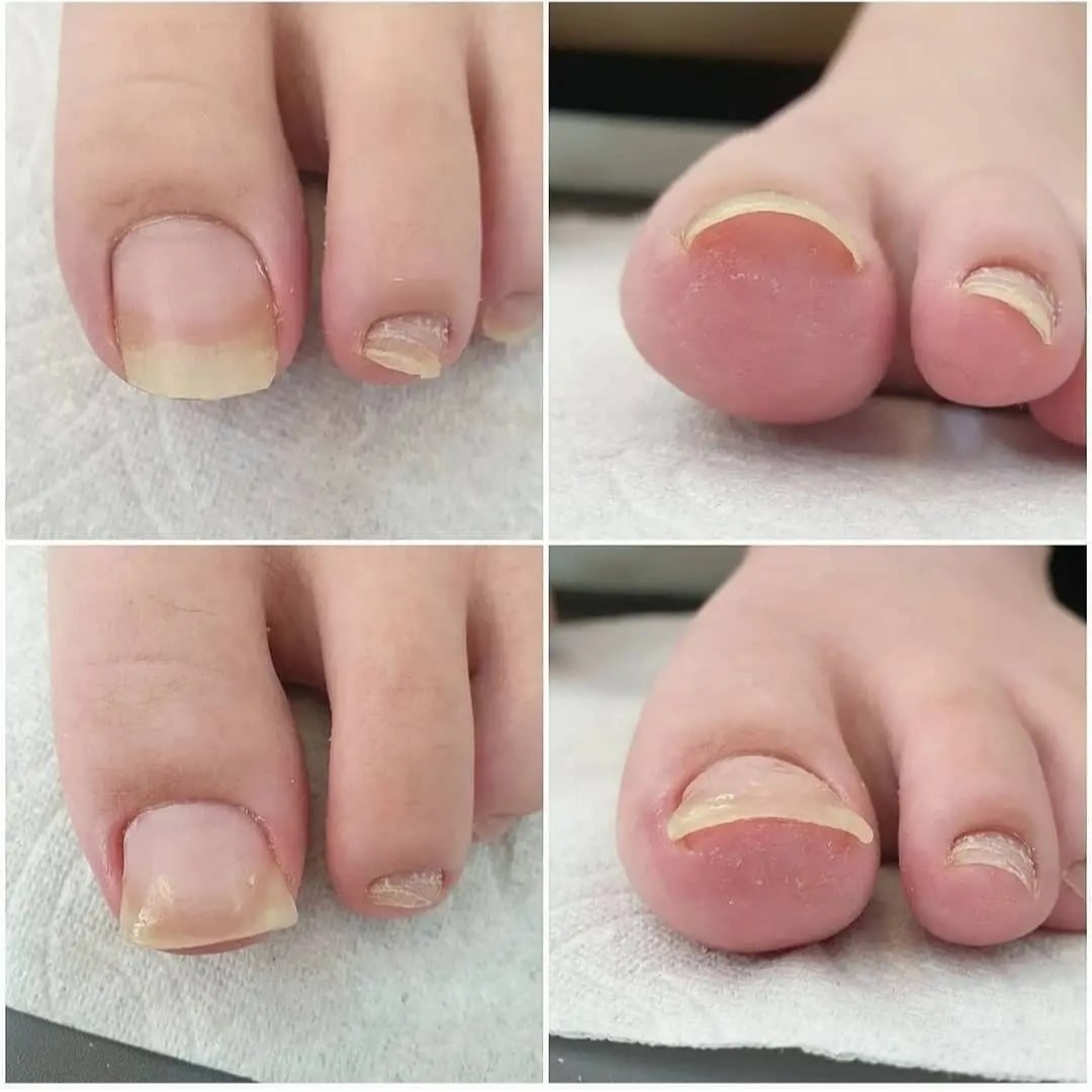 로제네일 대표 이미지