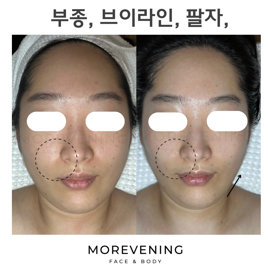 모어브닝 photo 7