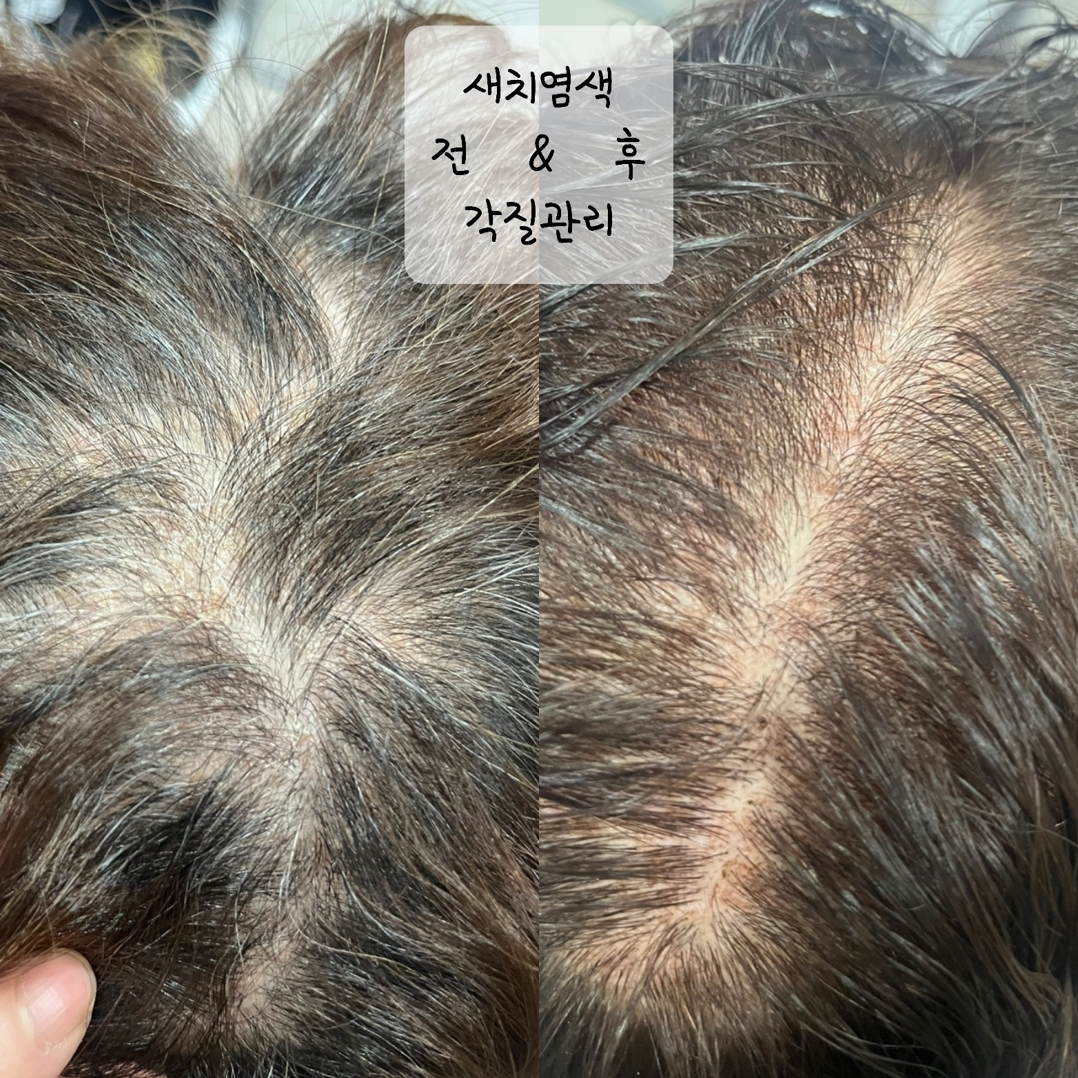 수앤큐사랑 염색 피부관리 속눈썹 두피탈모