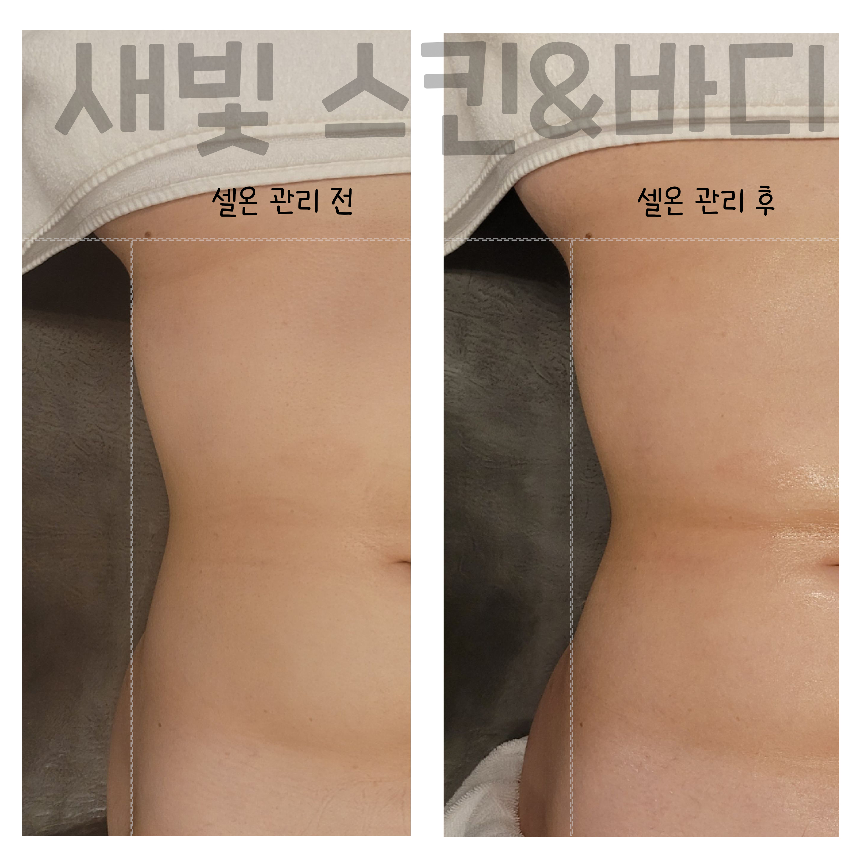 새빛스킨&바디 대표 이미지