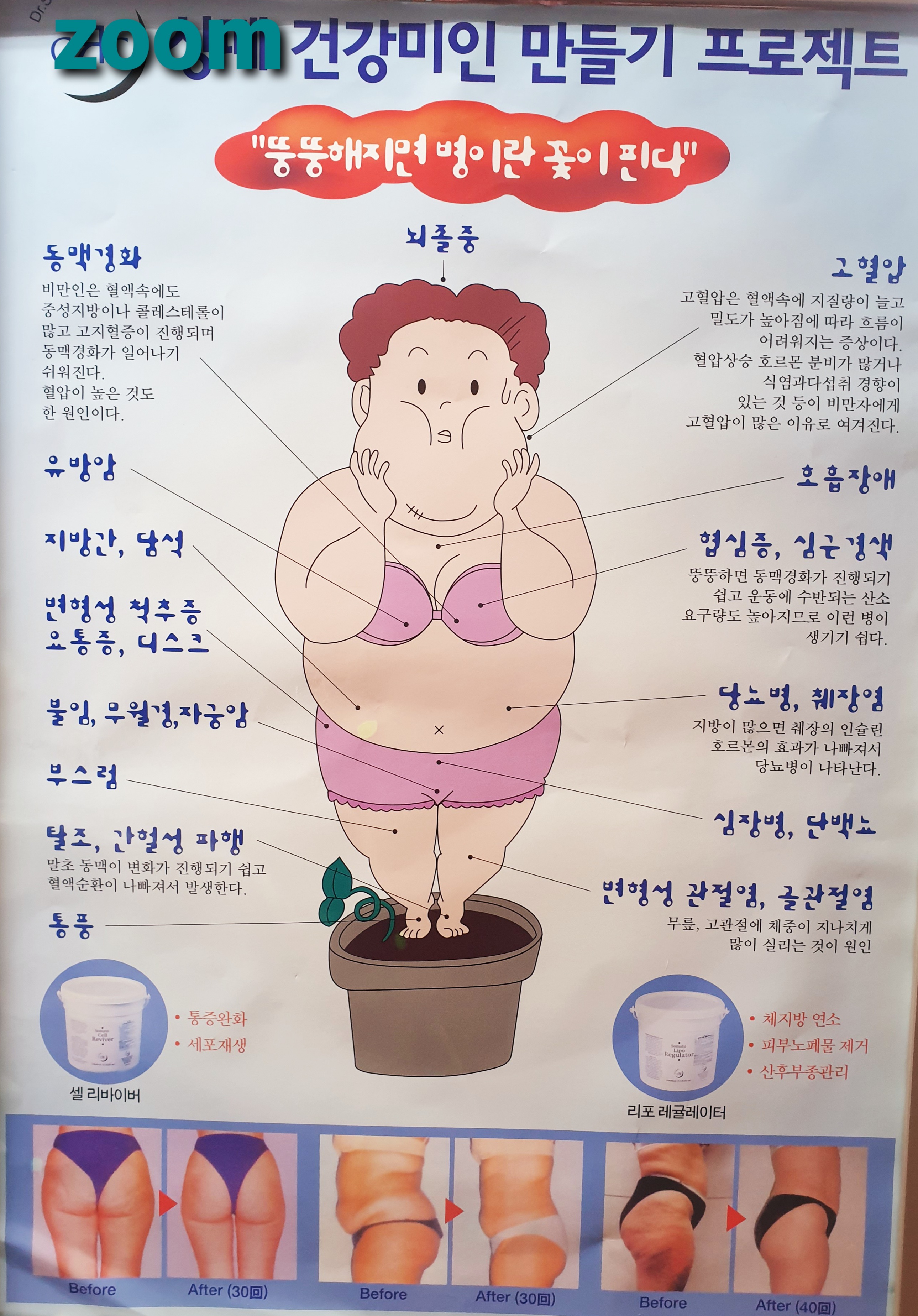줌피부샵 대표 이미지