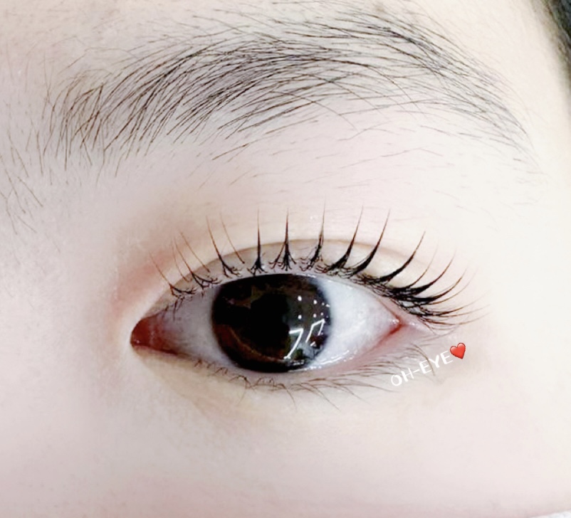 오아이