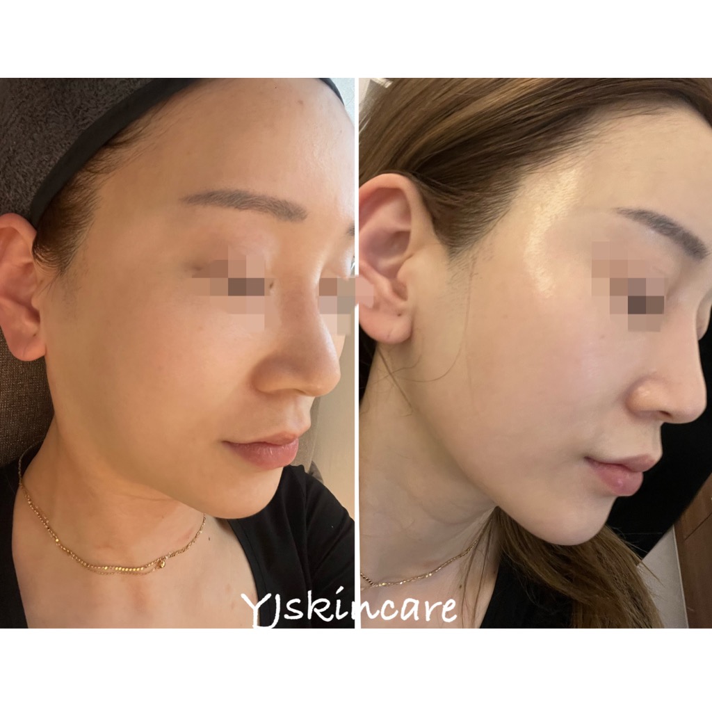 유진스킨케어