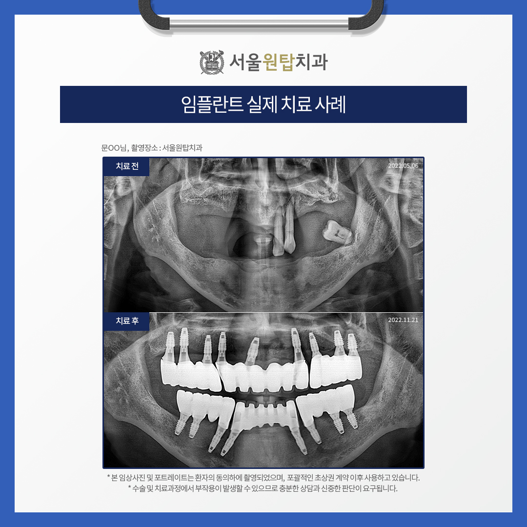 365서울원탑치과의원 대표 이미지