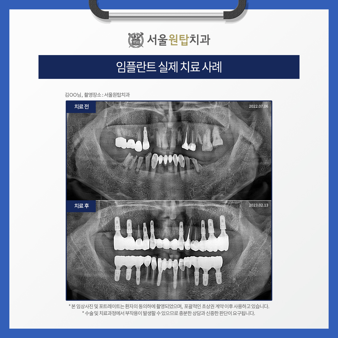 365서울원탑치과의원 대표 이미지