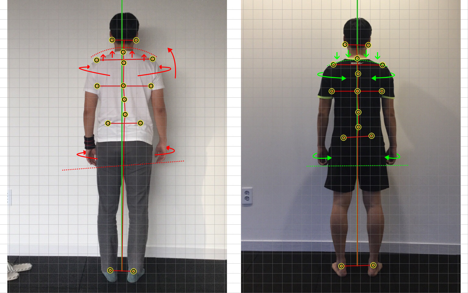 무브멘토 재활운동/체형교정센터 대표 이미지