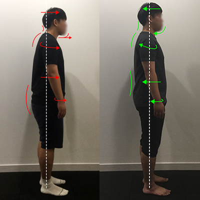 무브멘토 재활운동/체형교정센터 대표 이미지