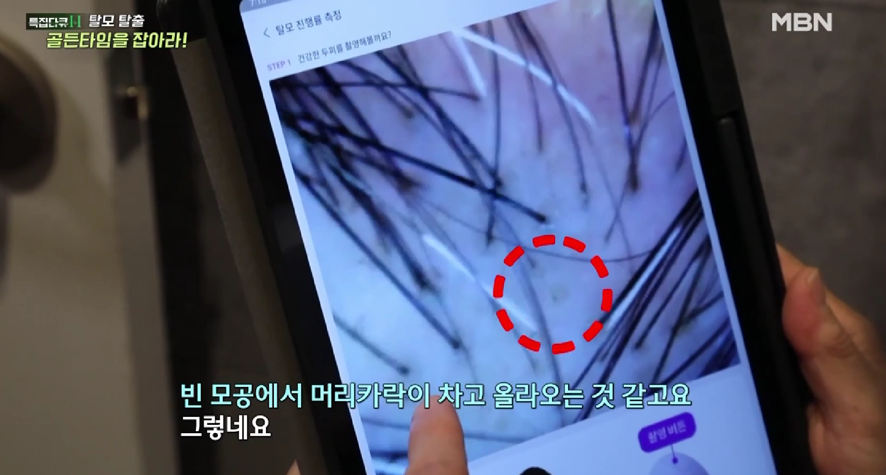 뉴헤어모발성형외과의원 대표 이미지