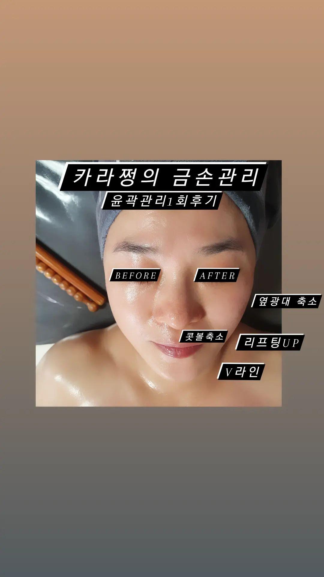 카라쩡의동안이야기 대표 이미지