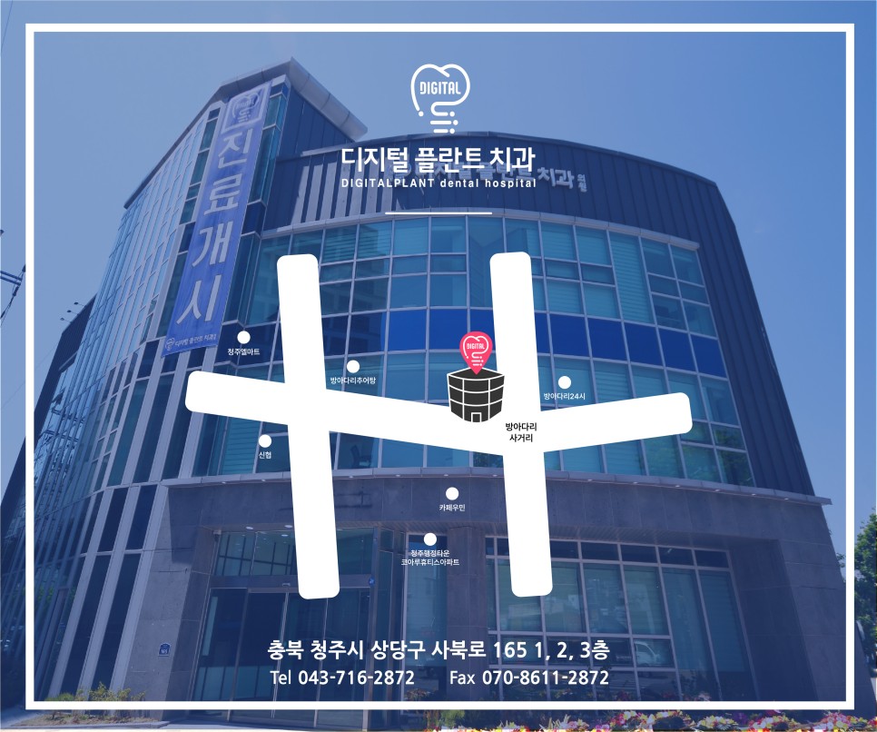 디지털플란트치과의원 대표 이미지
