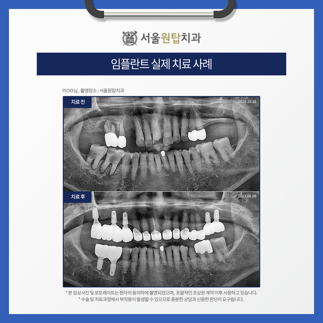 365서울원탑치과의원 대표 이미지