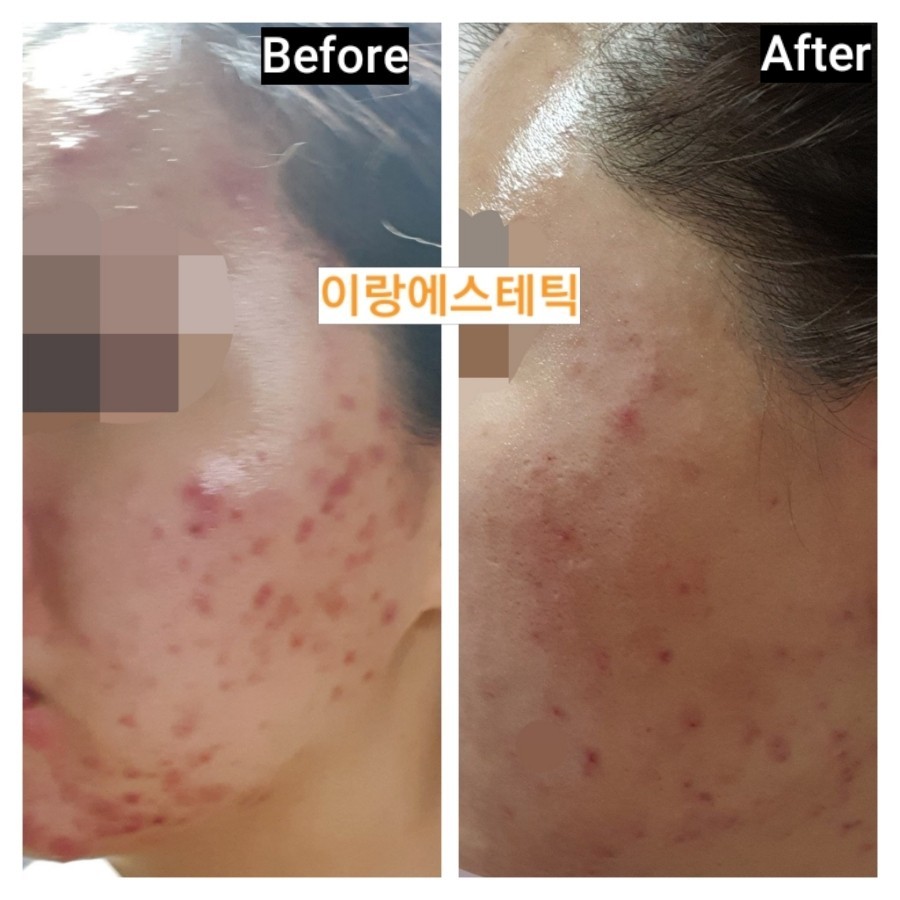 이랑에스테틱 미아본점 대표 이미지