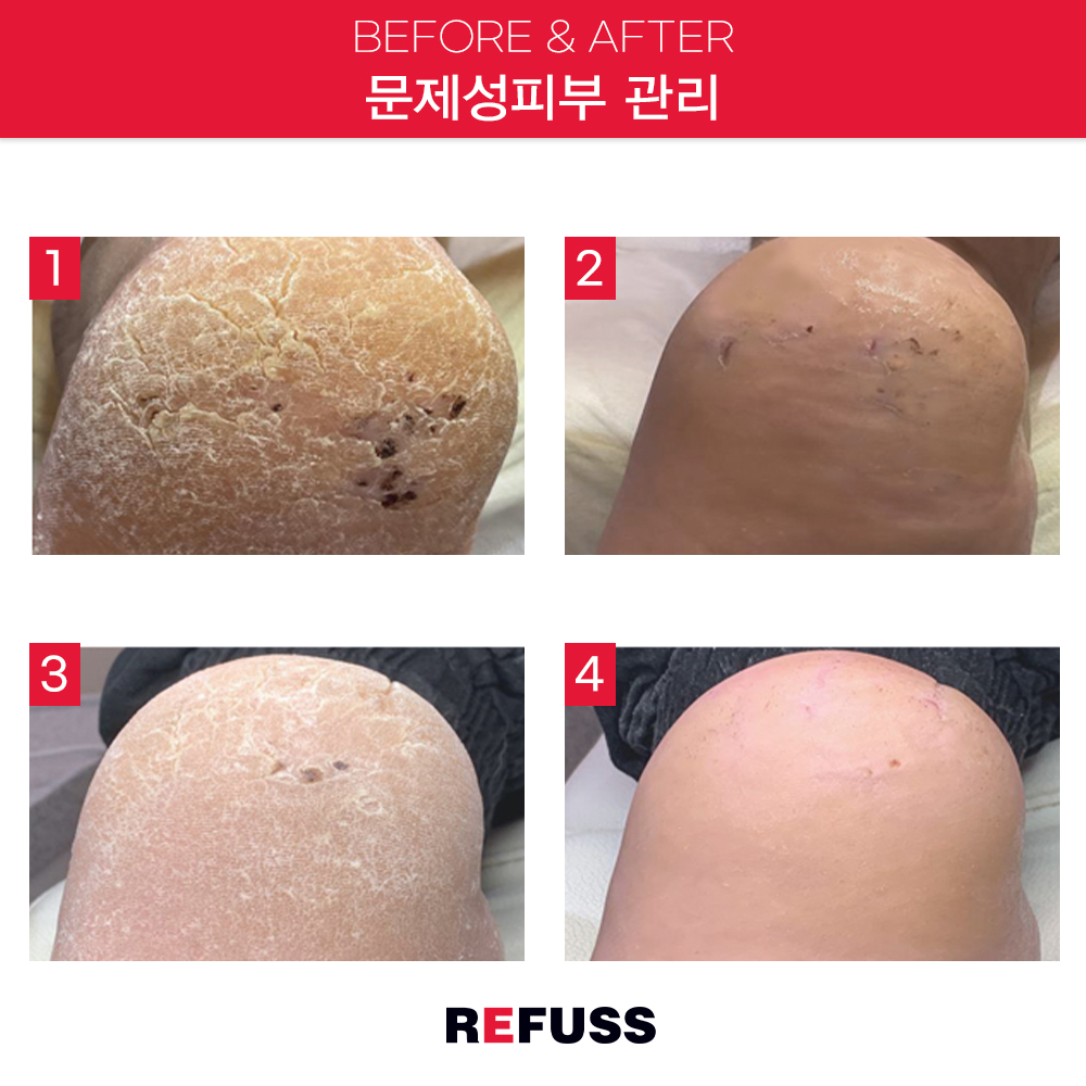 레푸스 종로점 대표 이미지