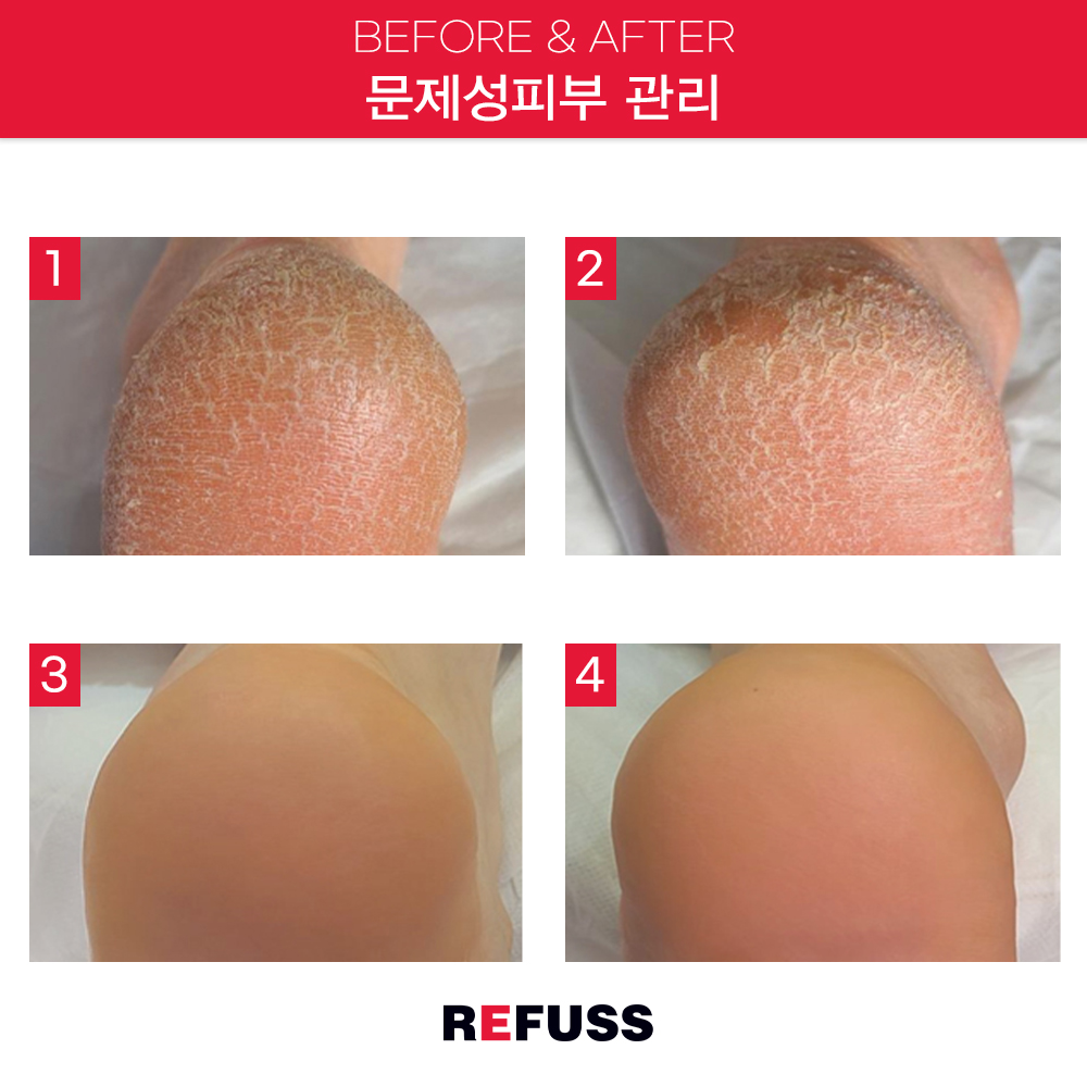 레푸스 종로점 대표 이미지