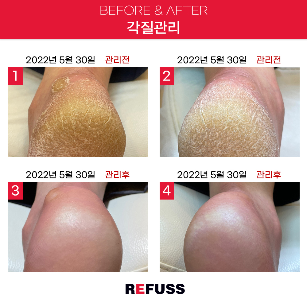 레푸스 종로점 대표 이미지