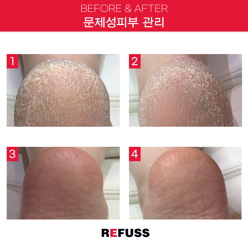 레푸스 종로점 대표 이미지