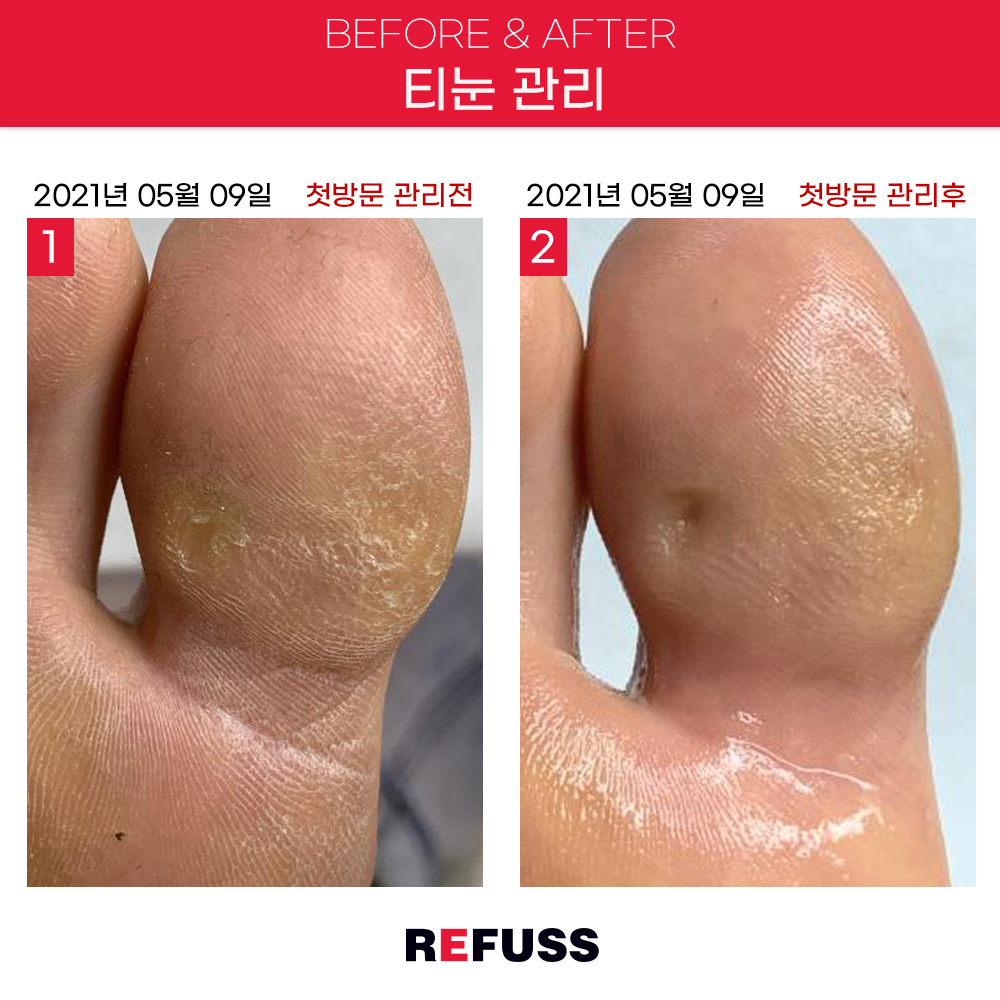 레푸스 종로점