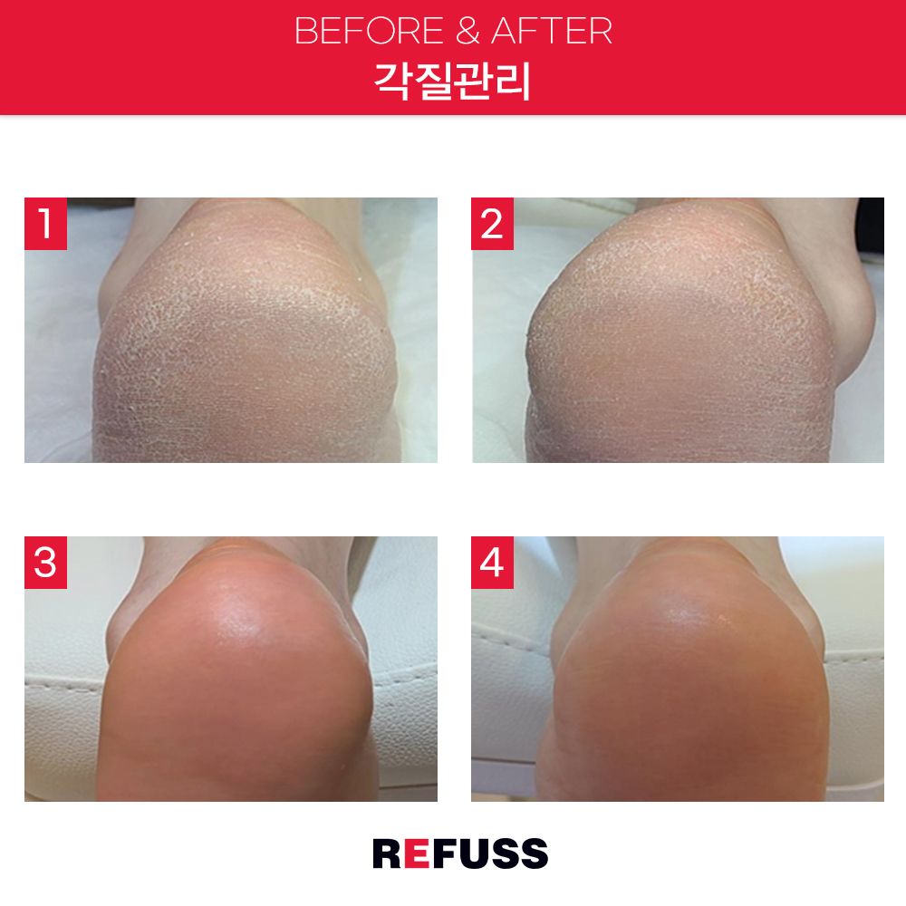 레푸스 종로점 대표 이미지