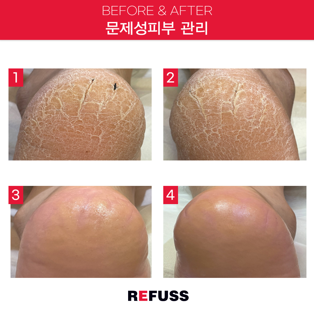 레푸스 종로점 대표 이미지