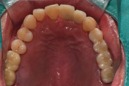 서울탑플란트치과 대표 이미지