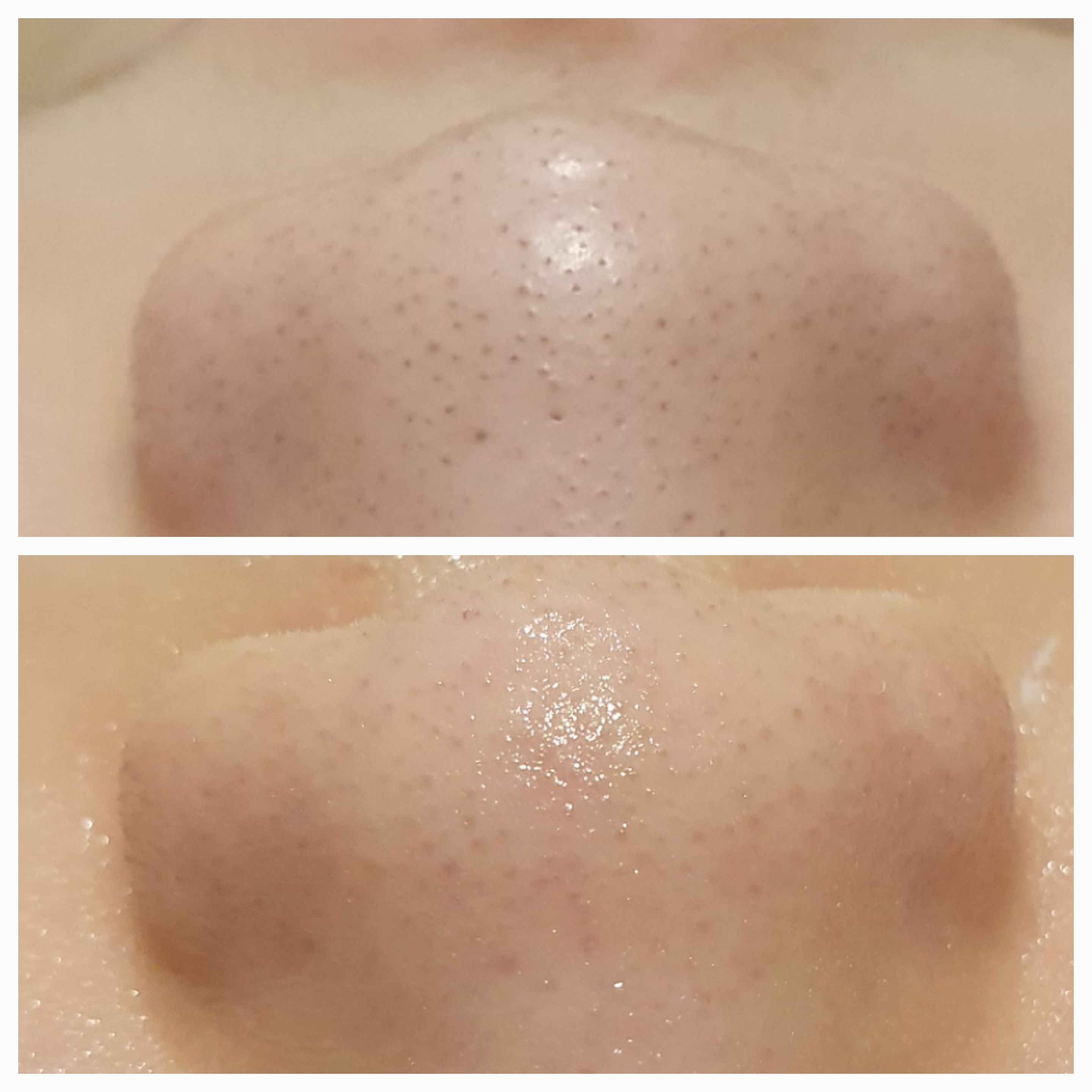 셀럽메디스파