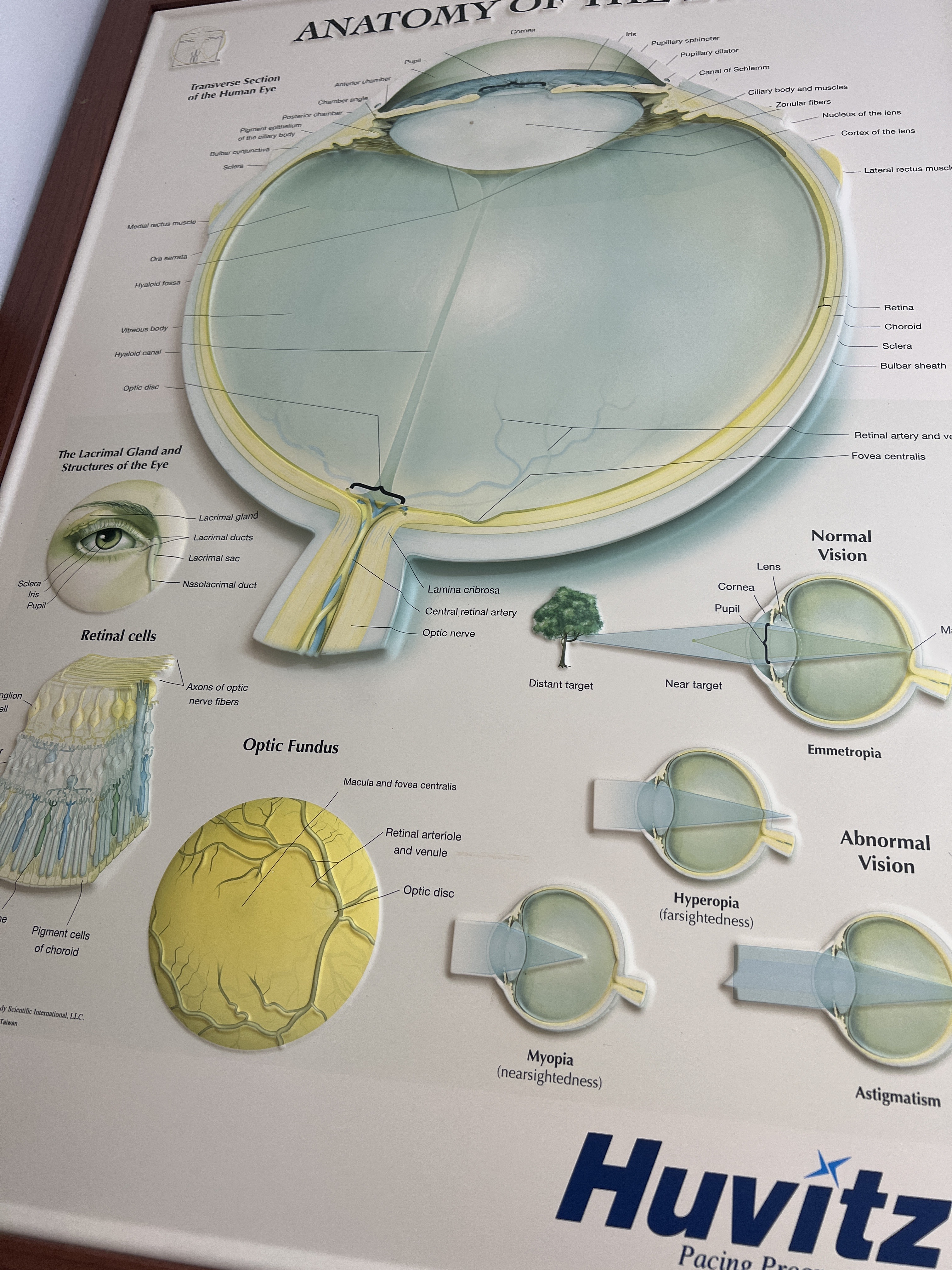 3713안경 대표 이미지