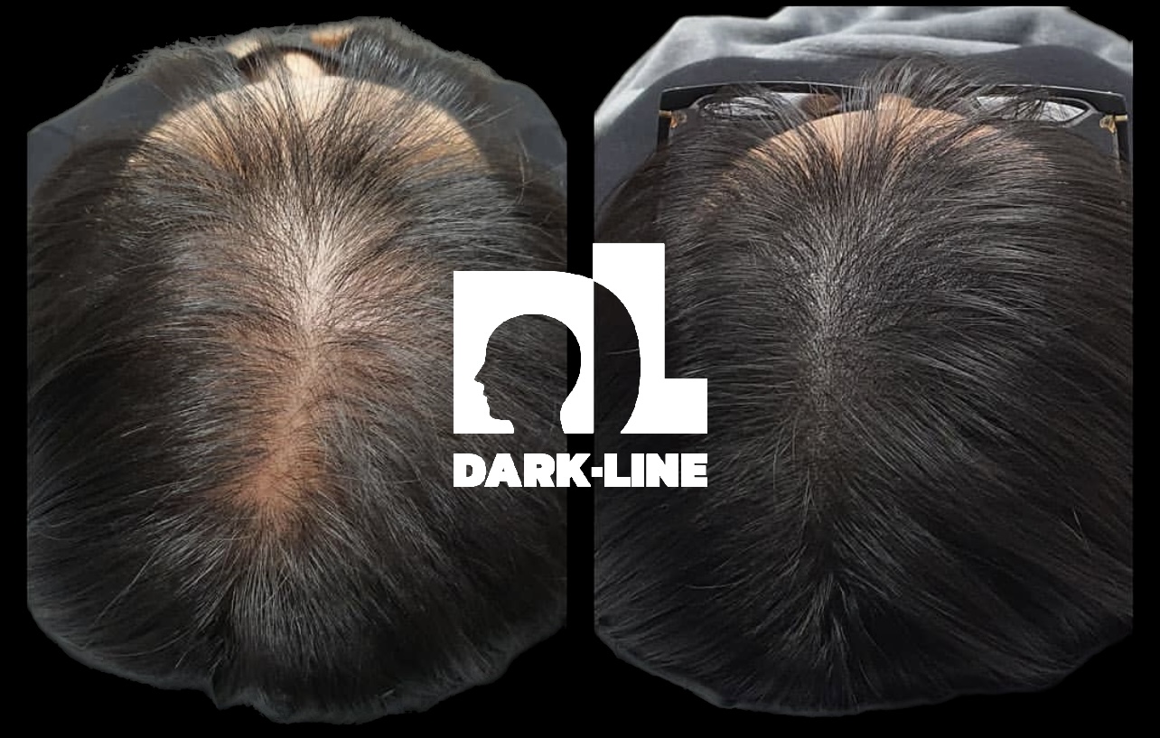 다크라인 대표 이미지