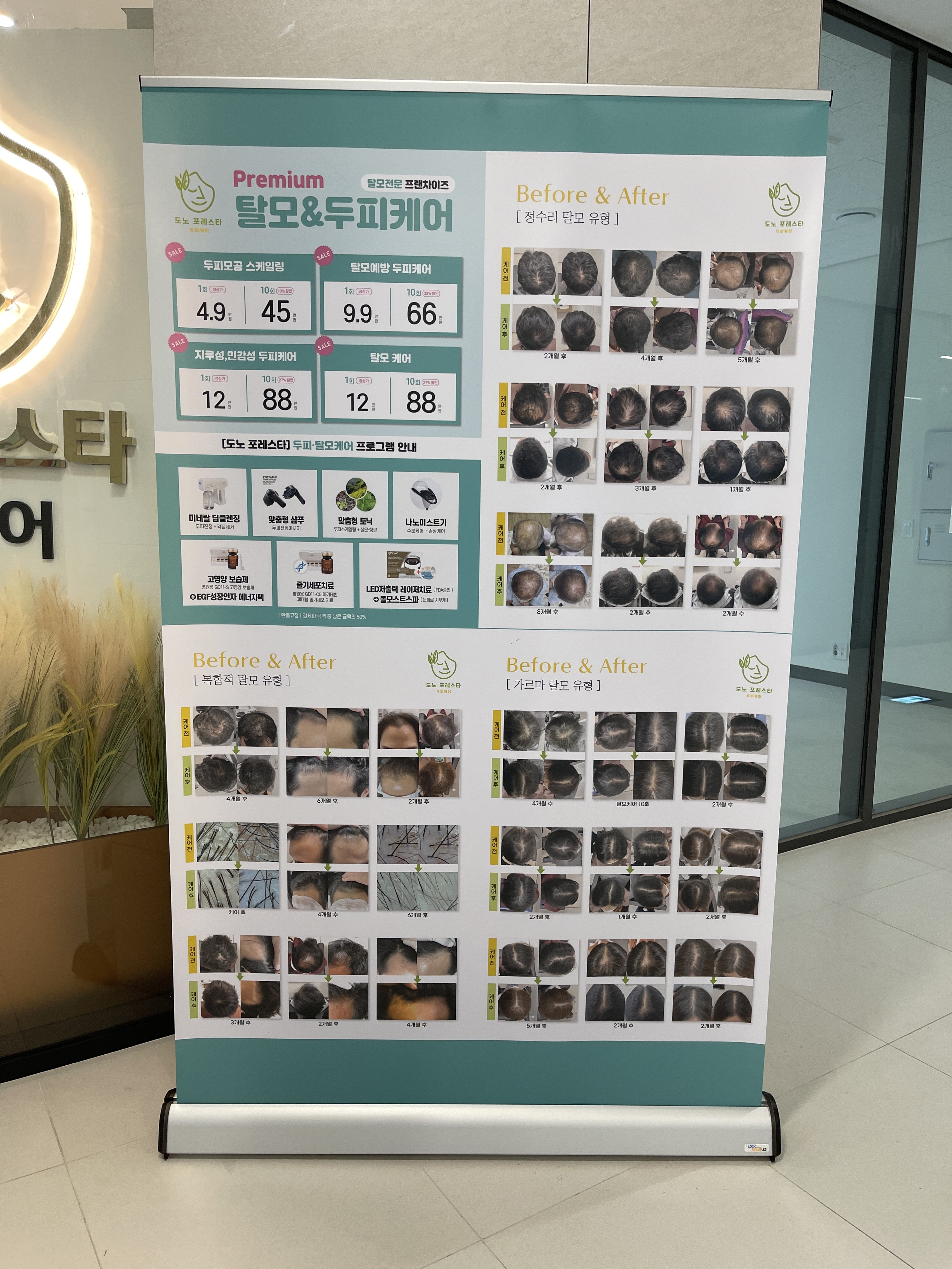 도노포레스타 두피케어 별내신도시점