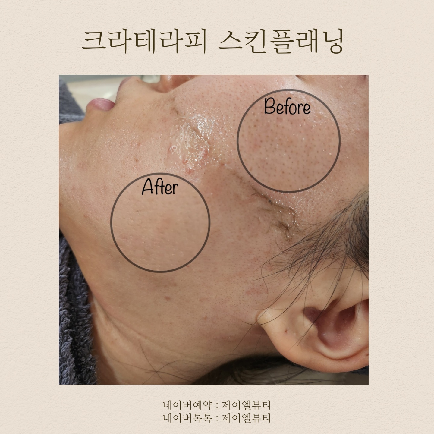 제이엘뷰티