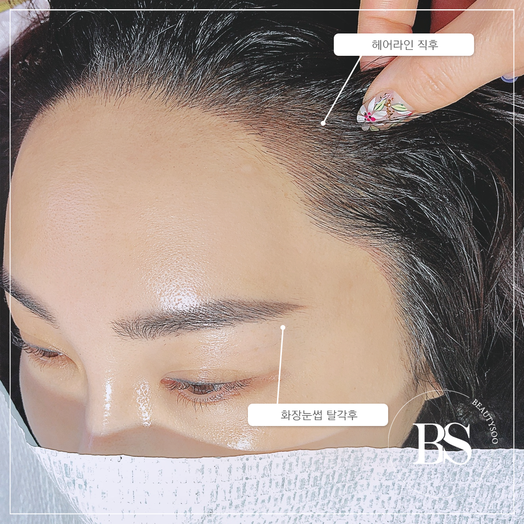 뷰티수