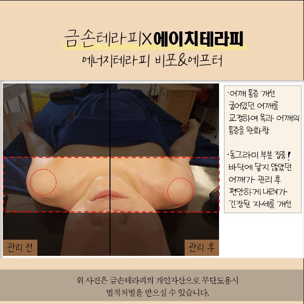 금손테라피
