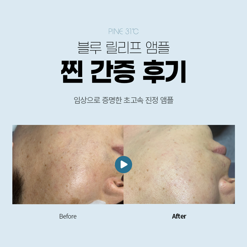 더맑은스킨 강화점 대표 이미지